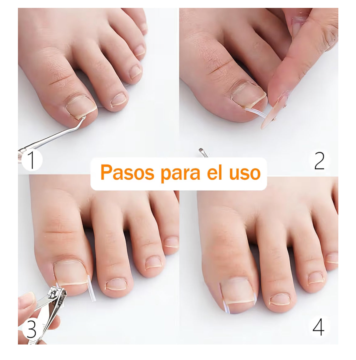 InGrowFix / Kit para uñas encarnadas