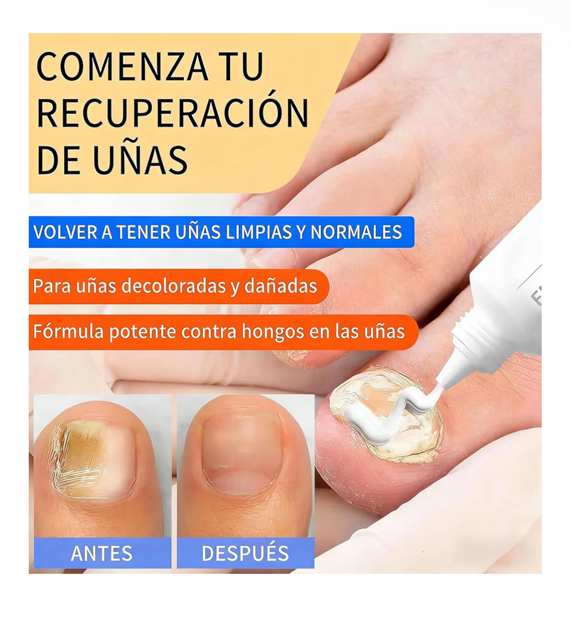 Crema para Hongos