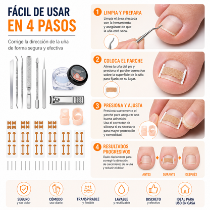 InGrowFix / Kit para uñas encarnadas