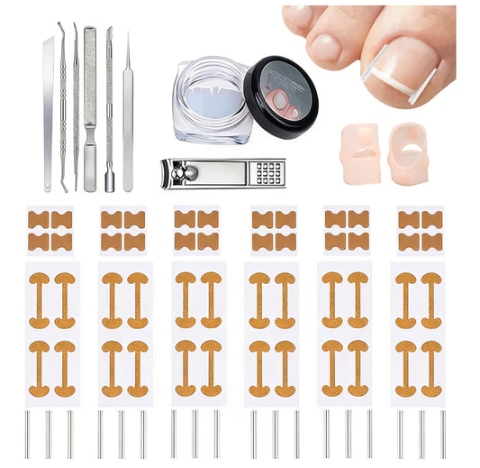 InGrowFix / Kit para uñas encarnadas