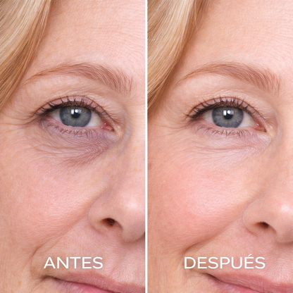 Eye Skin contorno de ojos