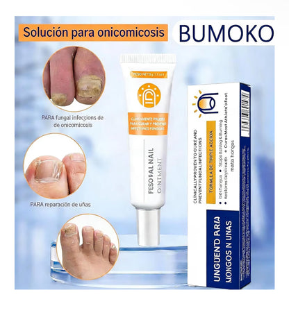 Crema para Hongos